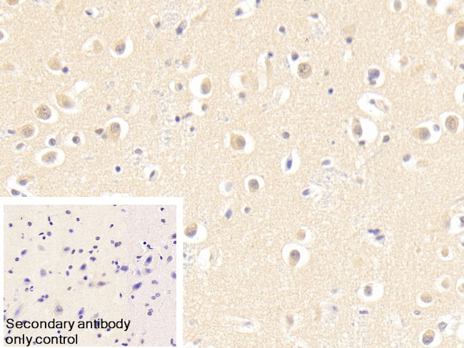 SKP1 Antibody in Immunohistochemistry (Paraffin) (IHC (P))