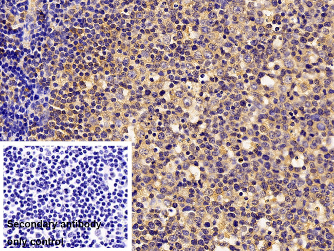 Syk Antibody in Immunohistochemistry (Paraffin) (IHC (P))