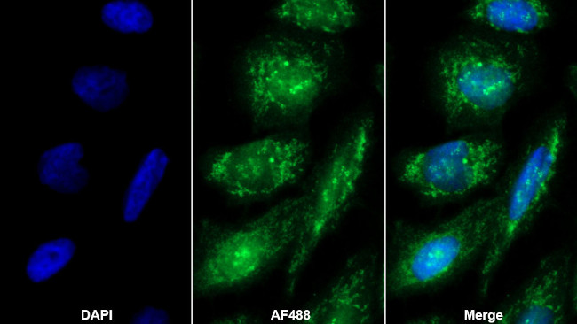 SULF2 Antibody in Immunocytochemistry (ICC/IF)