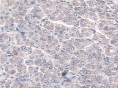 SULF2 Antibody in Immunohistochemistry (Paraffin) (IHC (P))
