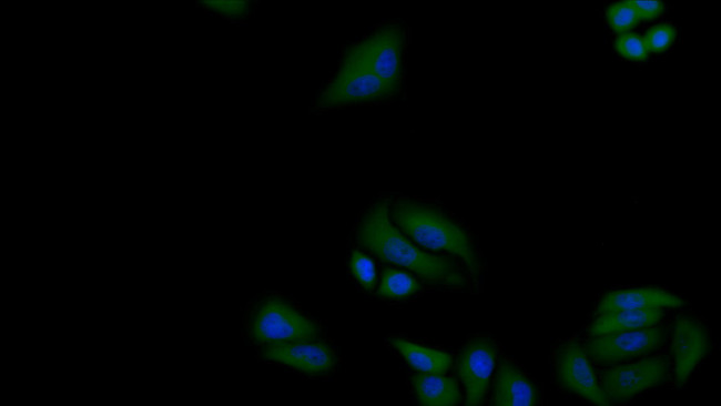 SOD2 Antibody in Immunocytochemistry (ICC/IF)