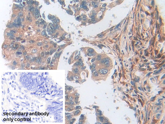 SOD2 Antibody in Immunohistochemistry (Paraffin) (IHC (P))