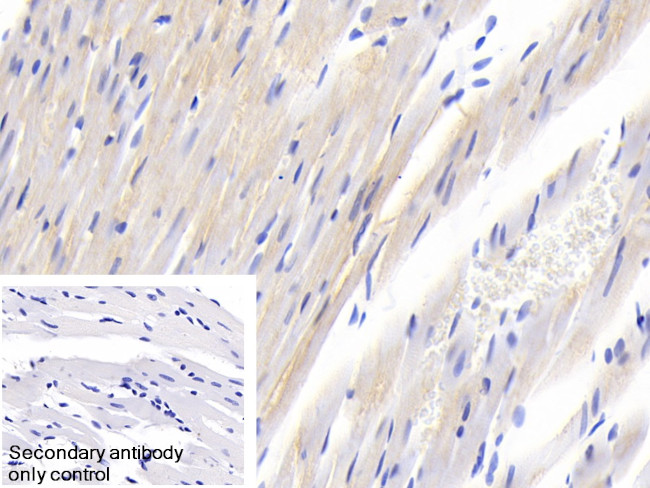 SOCS2 Antibody in Immunohistochemistry (Paraffin) (IHC (P))