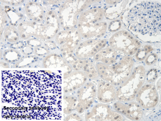 SMN2 Antibody in Immunohistochemistry (Paraffin) (IHC (P))