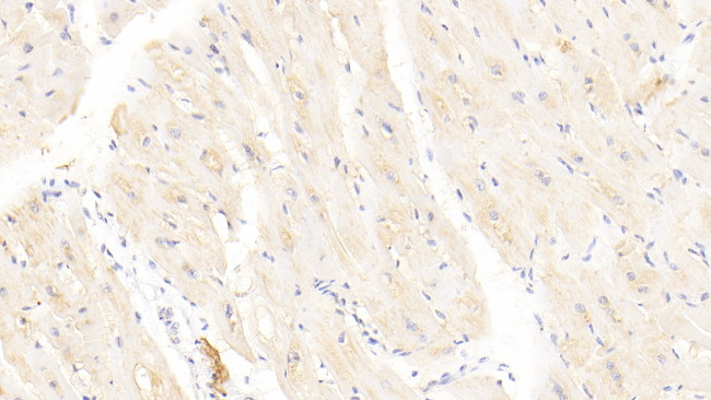 Syntenin 1 Antibody in Immunohistochemistry (Paraffin) (IHC (P))