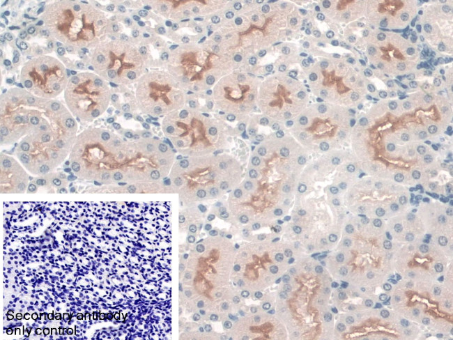 SNTB1 Antibody in Immunohistochemistry (Paraffin) (IHC (P))