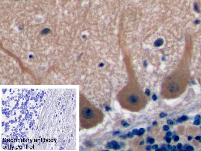 TSPAN1 Antibody in Immunohistochemistry (Paraffin) (IHC (P))