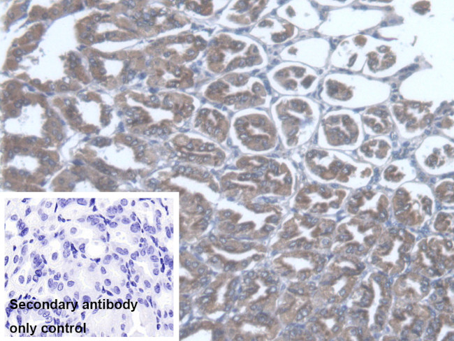 TST Antibody in Immunohistochemistry (Paraffin) (IHC (P))
