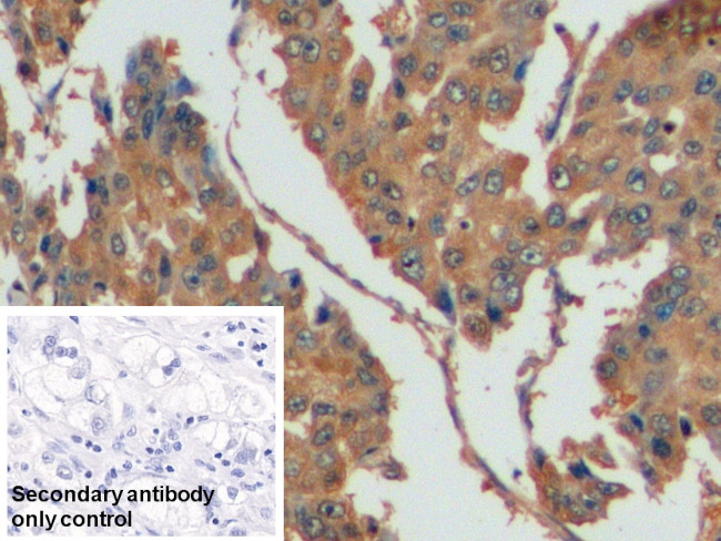 Thymidylate Synthase Antibody in Immunohistochemistry (Paraffin) (IHC (P))
