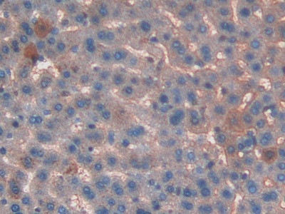 KNT1 Antibody in Immunohistochemistry (Paraffin) (IHC (P))