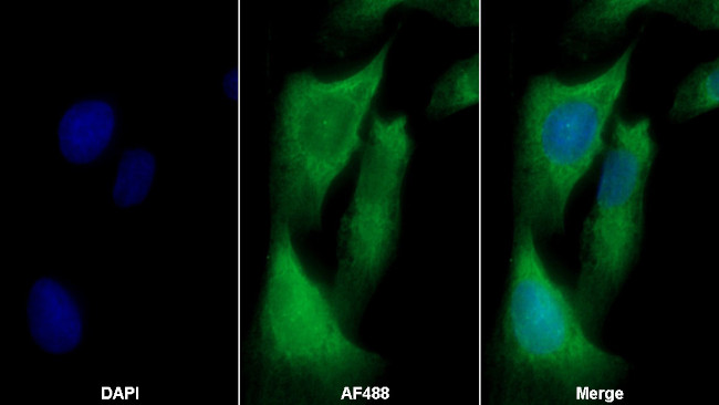 TL1A Antibody in Immunocytochemistry (ICC/IF)