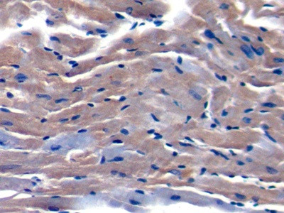 TOR2A Antibody in Immunohistochemistry (Paraffin) (IHC (P))