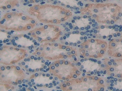 TOR3A Antibody in Immunohistochemistry (Paraffin) (IHC (P))