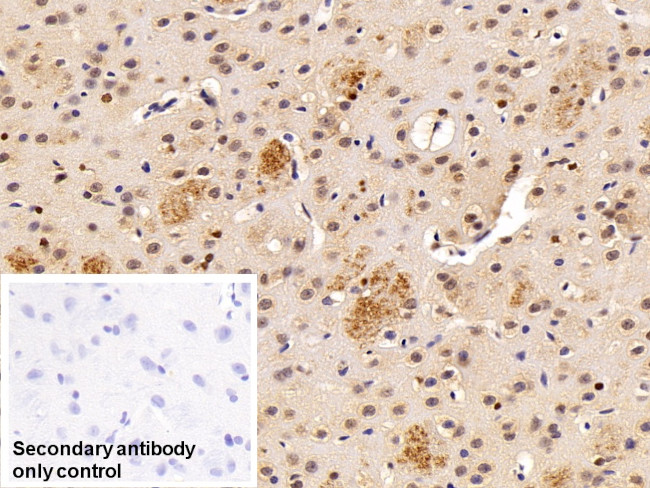 Transketolase Antibody in Immunohistochemistry (Paraffin) (IHC (P))