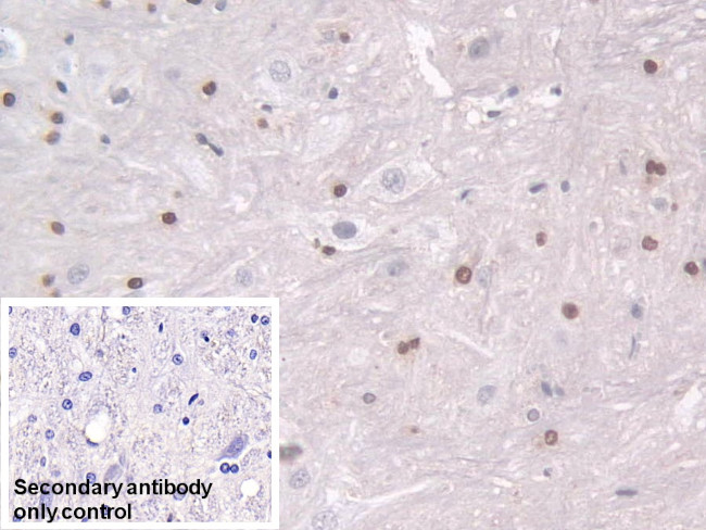 Transketolase Antibody in Immunohistochemistry (Paraffin) (IHC (P))