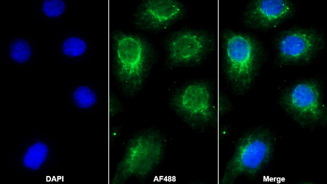 TPSB2 Antibody in Immunocytochemistry (ICC/IF)