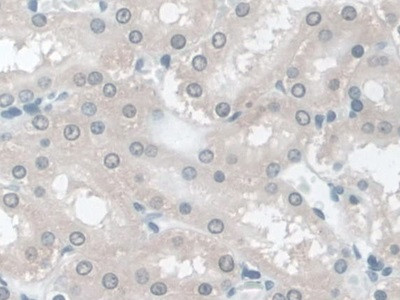 TPSB2 Antibody in Immunohistochemistry (Paraffin) (IHC (P))