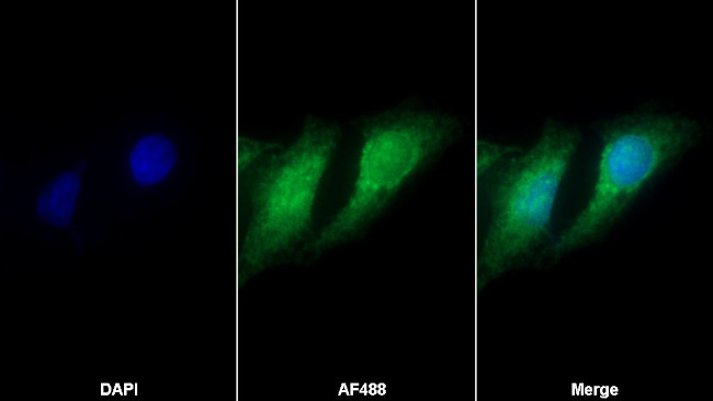 TTK Antibody in Immunocytochemistry (ICC/IF)