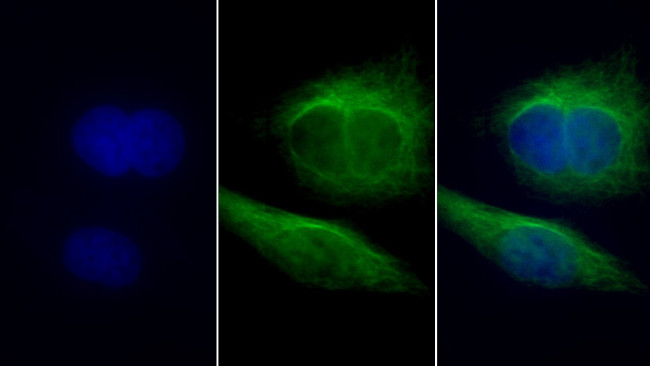 TUBB1 Antibody in Immunocytochemistry (ICC/IF)