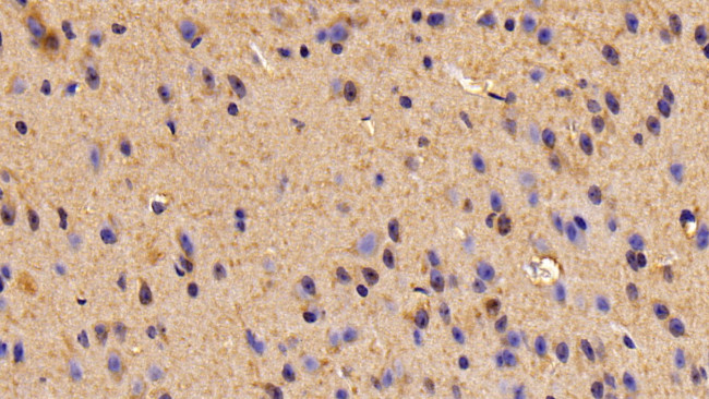 TUBB6 Antibody in Immunohistochemistry (Paraffin) (IHC (P))