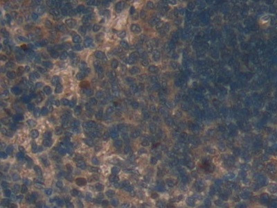 TUBD1 Antibody in Immunohistochemistry (Paraffin) (IHC (P))