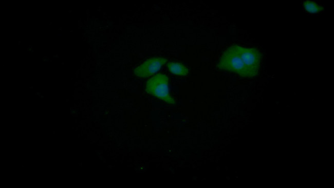 TPPP Antibody in Immunocytochemistry (ICC/IF)