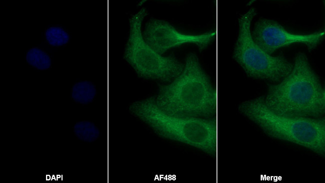 TNFR1 Antibody in Immunocytochemistry (ICC/IF)