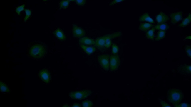 p53 Antibody in Immunocytochemistry (ICC/IF)