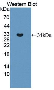 TYK2 Antibody in Western Blot (WB)