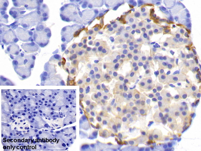 PGP9.5 Antibody in Immunohistochemistry (Paraffin) (IHC (P))