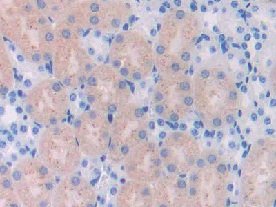 UCHL4 Antibody in Immunohistochemistry (Paraffin) (IHC (P))