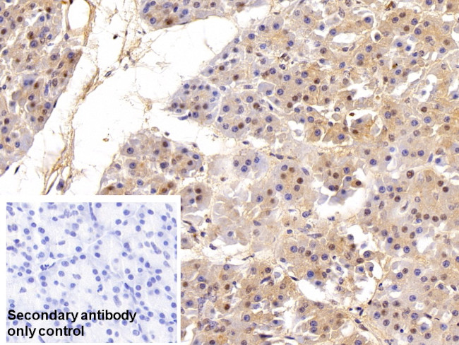 VCP Antibody in Immunohistochemistry (Paraffin) (IHC (P))