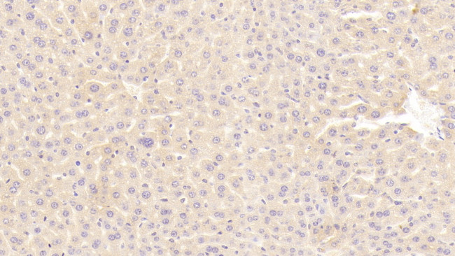 WFDC1 Antibody in Immunohistochemistry (Paraffin) (IHC (P))