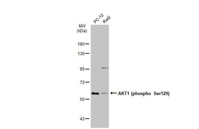Phospho-AKT1 (Ser129) Antibody in Western Blot (WB)