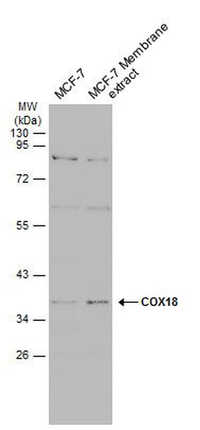 COX18 Antibody in Western Blot (WB)