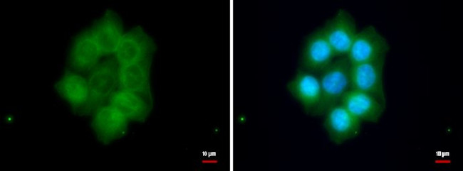 FAM46C Antibody in Immunocytochemistry (ICC/IF)