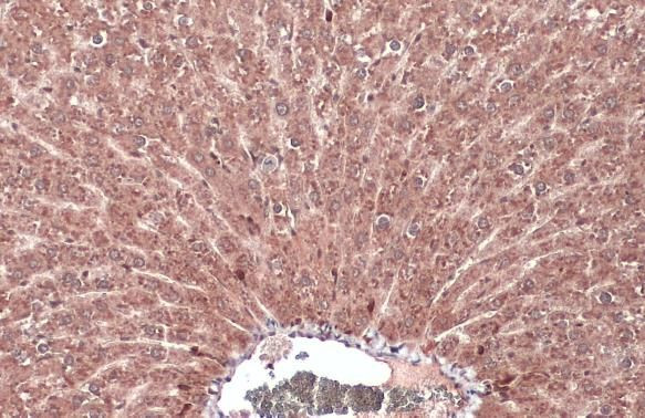 FGFR4 Antibody in Immunohistochemistry (Paraffin) (IHC (P))