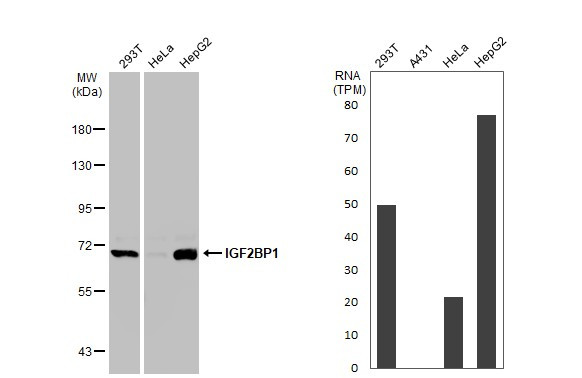 IGF2BP1 Antibody in Western Blot (WB)