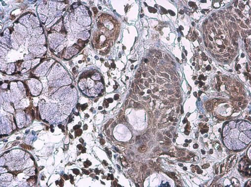 IL-17A Antibody in Immunohistochemistry (Paraffin) (IHC (P))