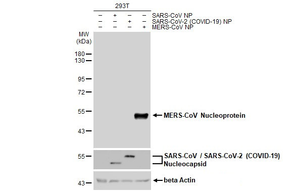 MERS Coronavirus NP Antibody in Western Blot (WB)