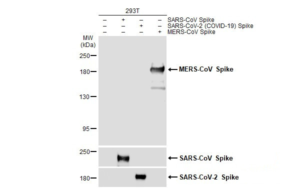MERS Coronavirus Spike Protein S1 Antibody in Western Blot (WB)