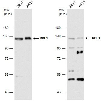RBL1 Antibody in Western Blot (WB)