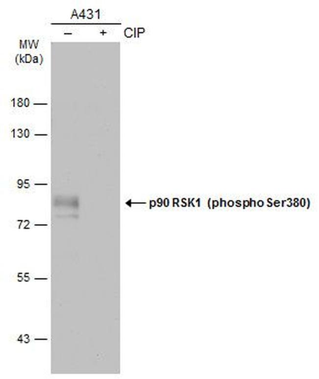 Phospho-RSK1 (Ser380) Antibody in Western Blot (WB)