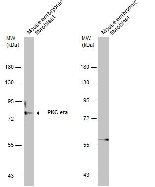 PKC eta Antibody in Western Blot (WB)