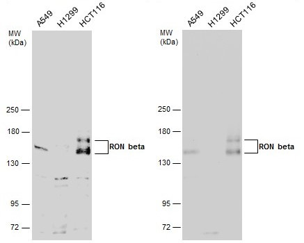 RON beta Antibody in Western Blot (WB)