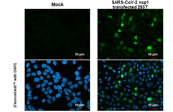 SARS-CoV-2 NSP1 Antibody in Immunocytochemistry (ICC/IF)