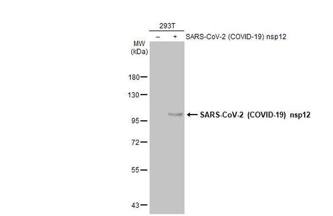 SARS-CoV-2 NSP12 Antibody in Western Blot (WB)