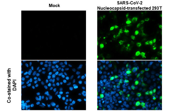 SARS/SARS-CoV-2 Nucleocapsid Antibody in Immunocytochemistry (ICC/IF)