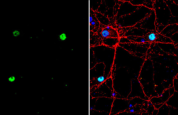 SATB2 Antibody in Immunocytochemistry (ICC/IF)