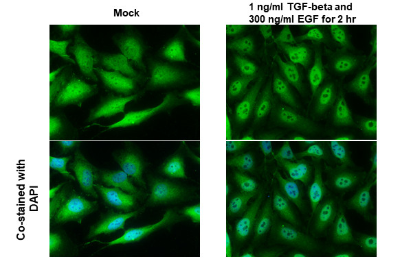 SNAIL Antibody in Immunocytochemistry (ICC/IF)